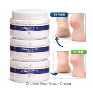 Verasoft-P Foot Care Cream | Soft Feet Cream | Helps Prevent Cracked Heels | 50 g
