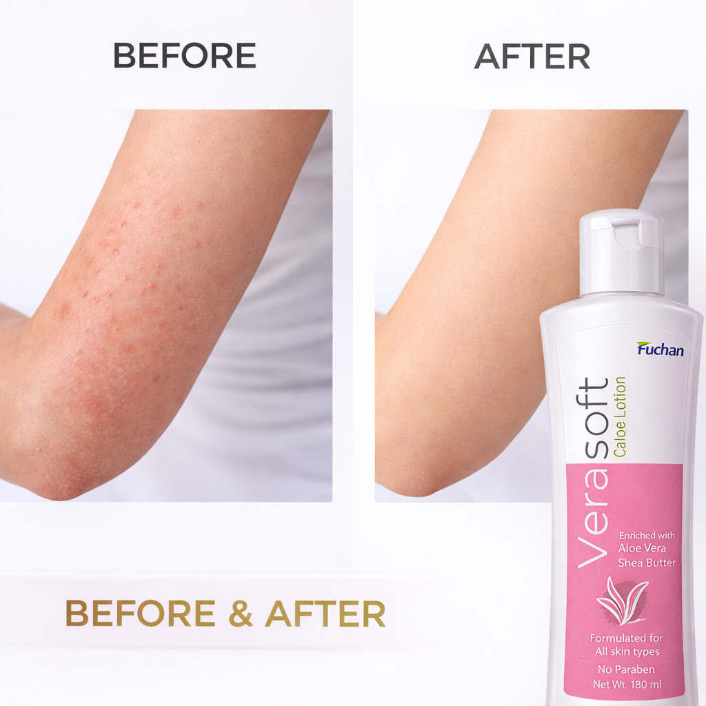 Verasoft Caloe Lotion Verasoft Caloe Lotion