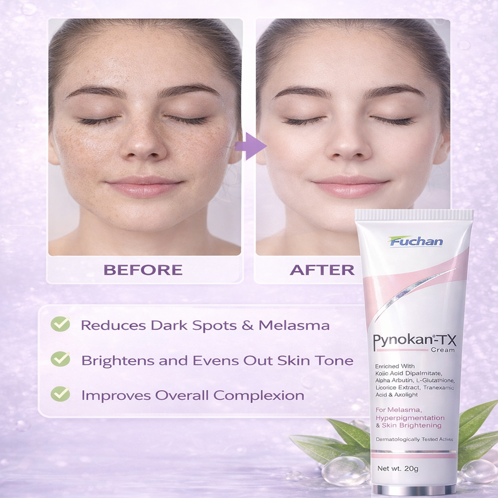 Pynokan TX Cream | Pynokan-TX Cream For Melasma & Hyperpigmentation