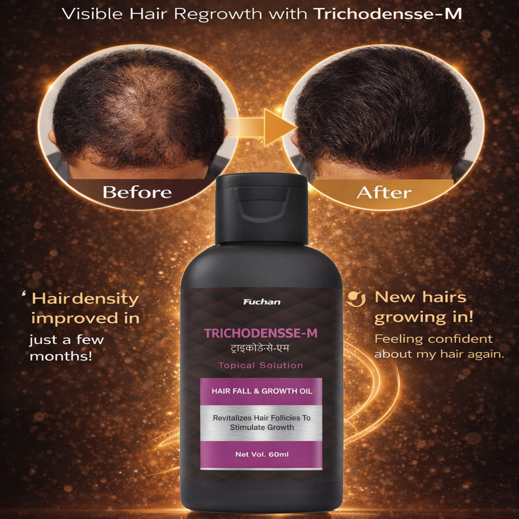 Trichodensse M Topical Solution | Hair Fall Control & Hair Regrowth Treatment Trichodensse M Topical Solution | Hair Fall Control & Hair Regrowth Treatment