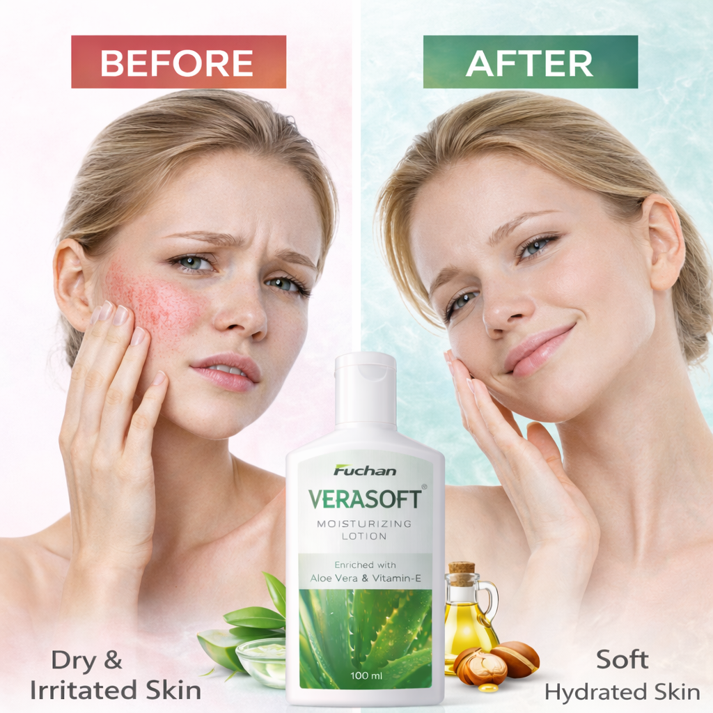 Verasoft Moisturizing Lotion with Aloe Vera & Vitamin-E | Deep Hydration for Soft & Healthy Skin | 100 ml Verasoft Moisturizing Lotion with Aloe Vera & Vitamin-E | Deep Hydration for Soft & Healthy Skin | 100 ml